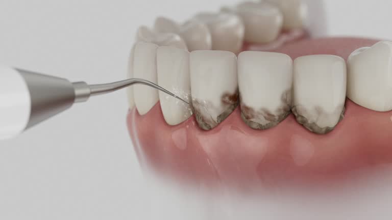 Reliable Dental Implants contractor in Tiffin, IA by Smile Center Dentistry